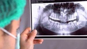 معرفی بهترین دستگاه های رادیوگرافی و تصوصیربرداری دندانپزشکی برای خرید