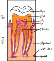 عصب کشی دندان توسط دندانپزشکان یا اندو برای چیست؟ 