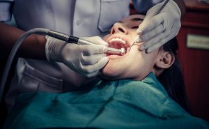 انواع دندان پوسیده و عصب کشی آن ها