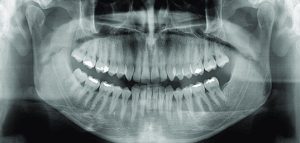 دستگاه های رادیوگرافی و تجهیزات تصوصیربرداری دندانپزشکی در ایران